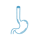 Eosinophilic Esophagitis