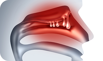 Additional Surgery image